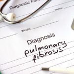 pulmonary-fibrosis