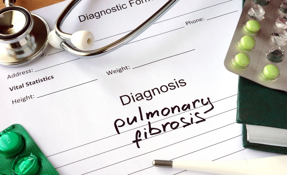 Facts About Pulmonary Fibrosis