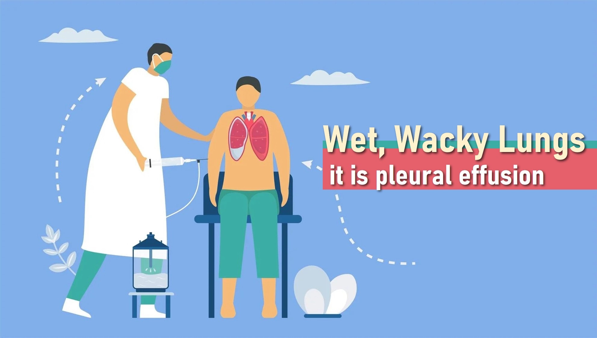 Wet, Wacky Lungs: What is Pleural Effusion?
